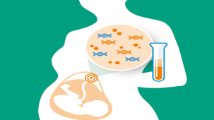 کاربرد تست غیر تهاجمی پیش از تولد (NIPT)  در تشخیص ناهنجاری های جنین